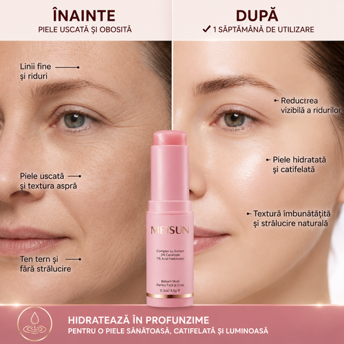 Balsam Facial și Corporal pentru Hidratare Intensă și Aspect Neted al Pielii